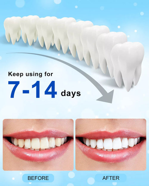 BrightQuick LED Smile Kit